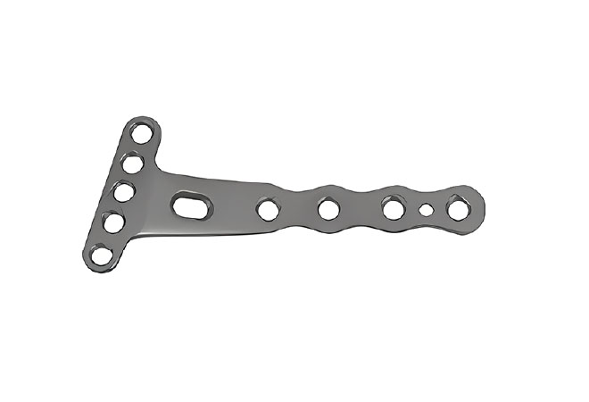 Блокуюча пластина для передньої поверхні дистального відділу променевої кістки Jinlu